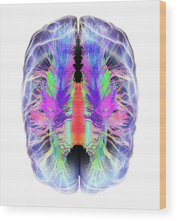 Brain Wood Print featuring the photograph White Matter Fibres And Brain by Alfred Pasieka