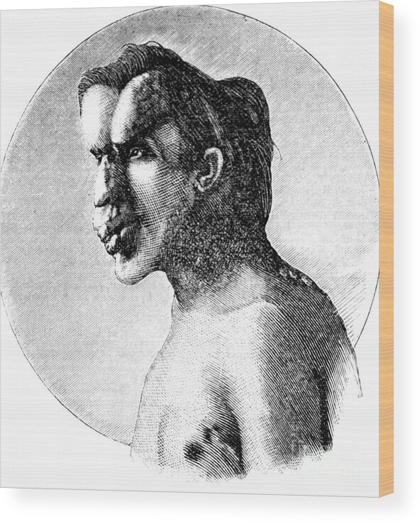 Science Wood Print featuring the photograph Joseph Merrick, The Elephant Man #4 by Science Source