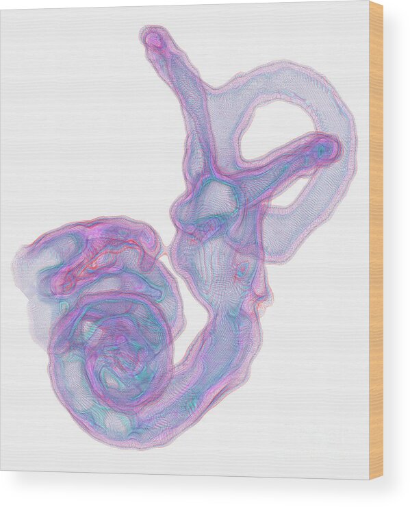 Cochlea Wood Print featuring the photograph Inner Ear Structures #1 by K H Fung/science Photo Library