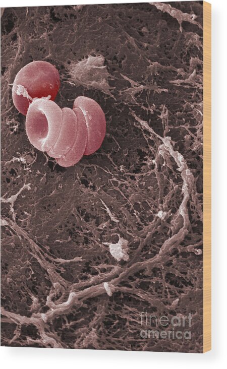 Science Wood Print featuring the photograph Human Red Blood Cells, Sem #15 by Ted Kinsman