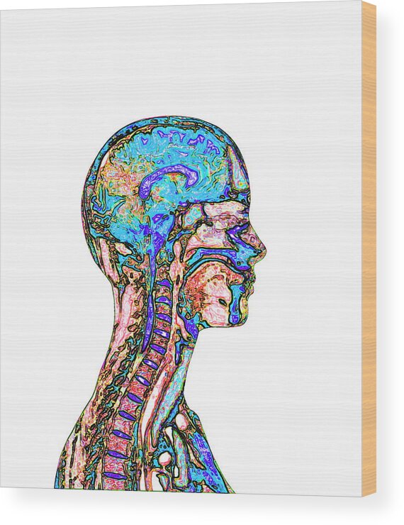 Brain Wood Print featuring the photograph Brain And Spinal Cord #3 by Mehau Kulyk