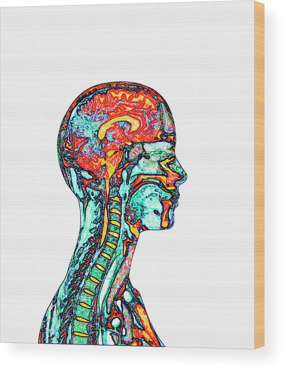 Brain Wood Print featuring the photograph Brain And Spinal Cord by Mehau Kulyk