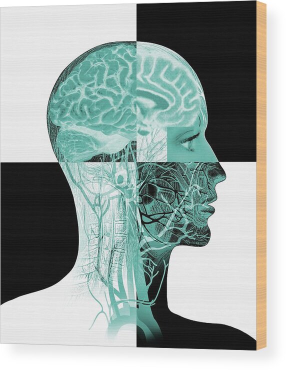 People Person Persons Wood Print featuring the photograph Brain Anatomy by Mehau Kulyk