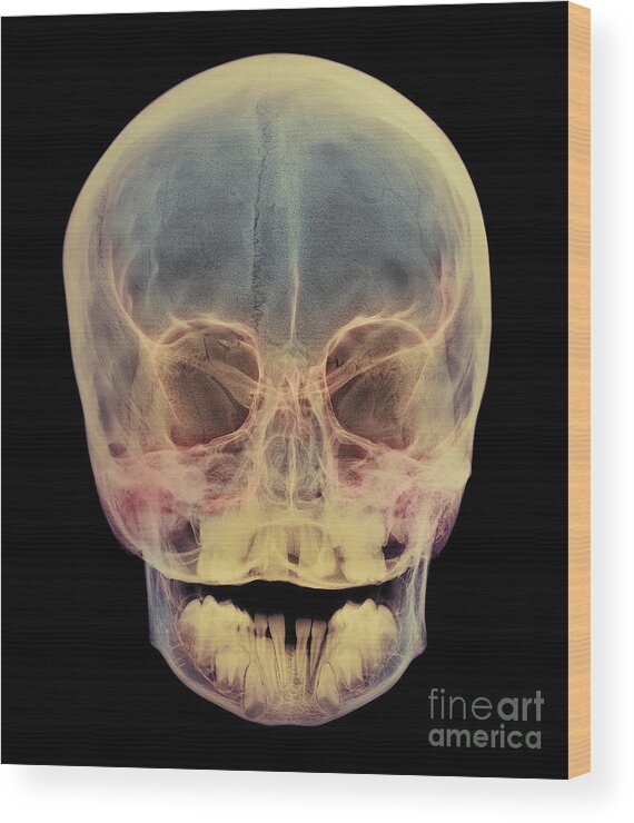 Child Wood Print featuring the photograph Child's Skull #9 by D. Roberts/science Photo Library