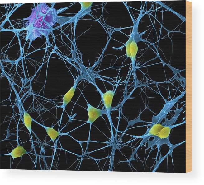 8705g Wood Print featuring the photograph Cortical Neurons #1 by Dennis Kunkel Microscopy/science Photo Library
