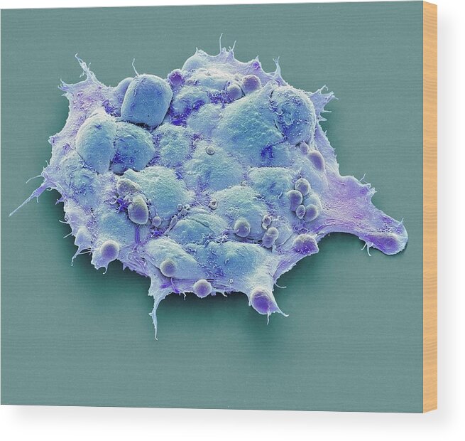 Biochemical Wood Print featuring the photograph Pluripotent Stem Cells #2 by Steve Gschmeissner