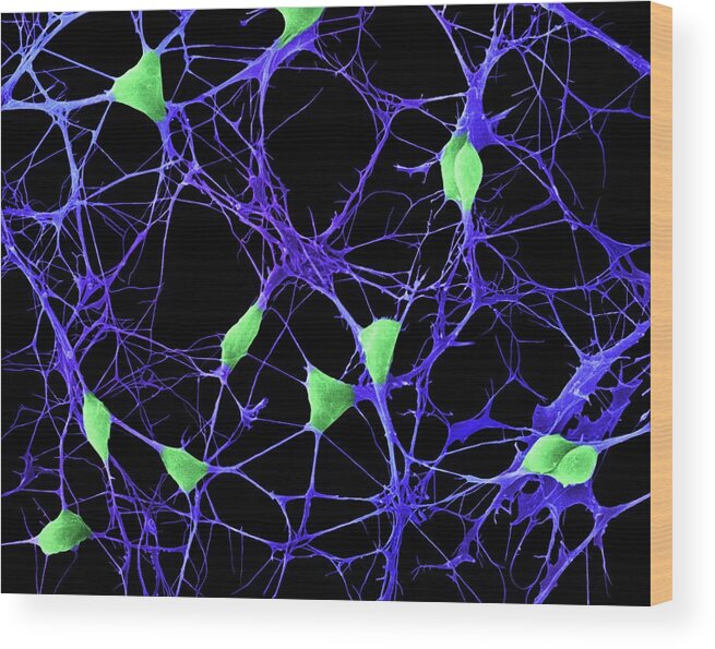 8799e Wood Print featuring the photograph Cortical Neurons #3 by Dennis Kunkel Microscopy/science Photo Library