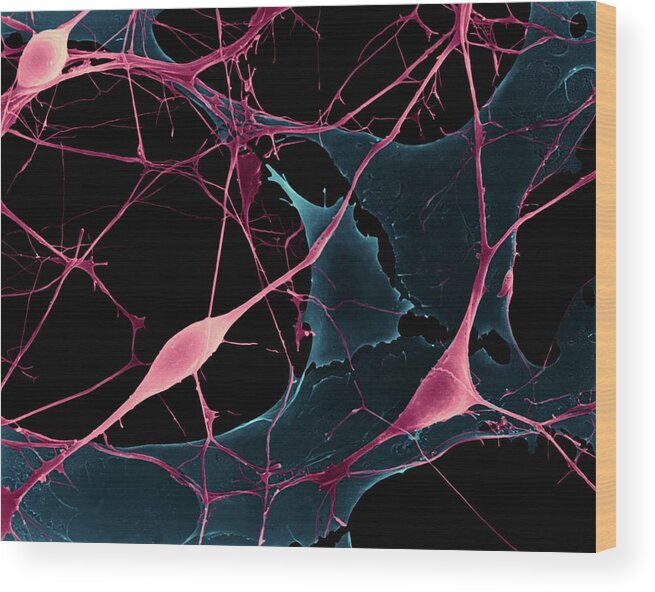 92752c Wood Print featuring the photograph Pyramidal Neurons From Cns #3 by Dennis Kunkel Microscopy/science Photo Library
