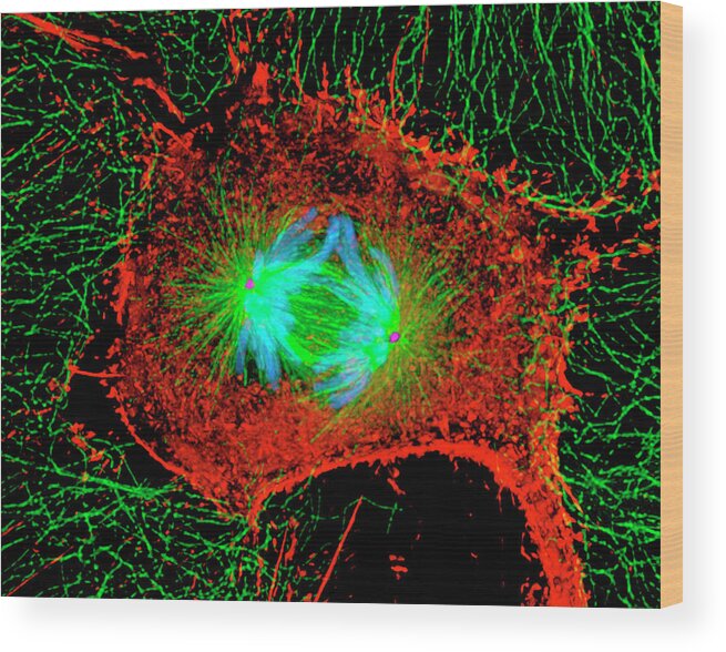 Magnified Image Wood Print featuring the photograph Mitosis Cell Division by Dr Alexey Khodjakov/science Photo Library