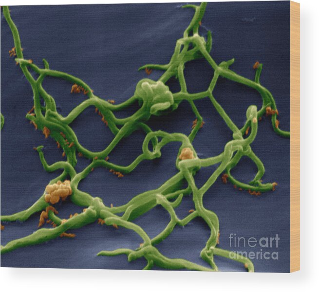 Micrograph Wood Print featuring the photograph Borrelia Burgdorferi by Eye of Science