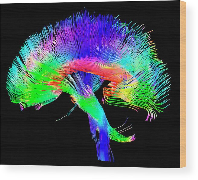 White Matter Wood Print featuring the photograph Brain Pathways by Tom Barrick, Chris Clark, Sghms