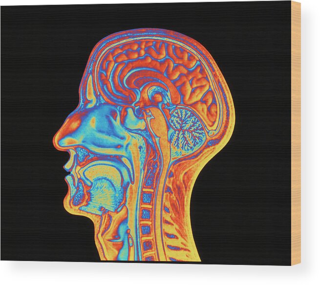 People Person Persons Wood Print featuring the photograph Coloured Mri Scan Of The Human Head (side View) by Pasieka
