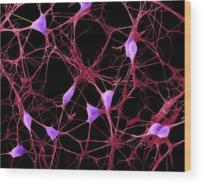 Central Nervous System Wood Print featuring the photograph Cortical Neurons by Dennis Kunkel Microscopy/science Photo Library