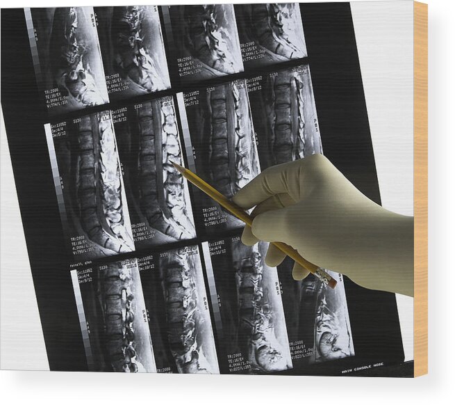 Expertise Wood Print featuring the photograph Lower back MRI scan with gloved physician's hand & pencil by FreezeFrameStudio