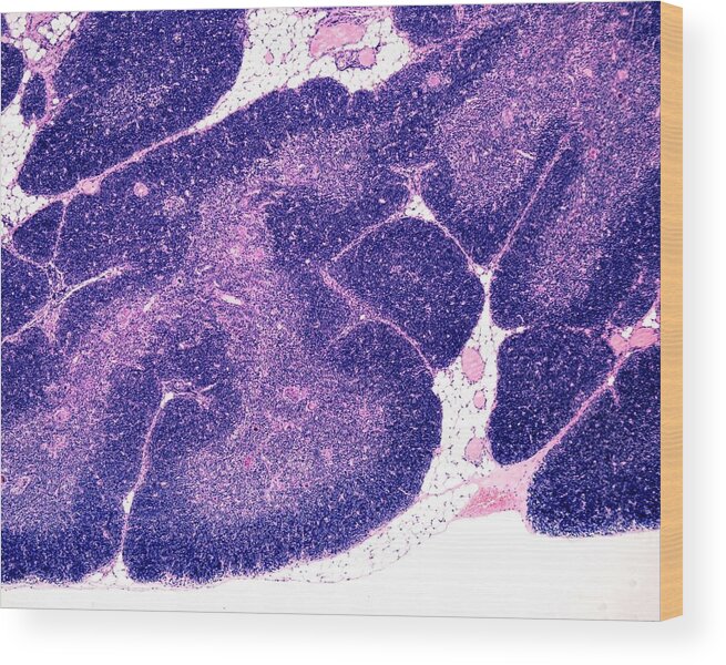 Biology Wood Print featuring the photograph Thymus by Jose Calvo / Science Photo Library