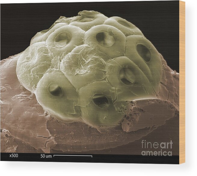 Scanning Electron Micrograph Wood Print featuring the photograph Sem Of A Head Lice Eggs #1 by Ted Kinsman