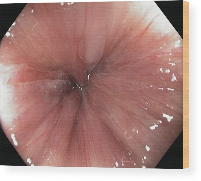 Healthy Anus #2 Wood Print