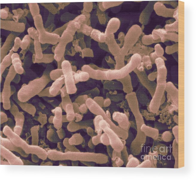 Bifidobacterium Longum Wood Print featuring the photograph Bifidobacterium Longum, Sem by Scimat