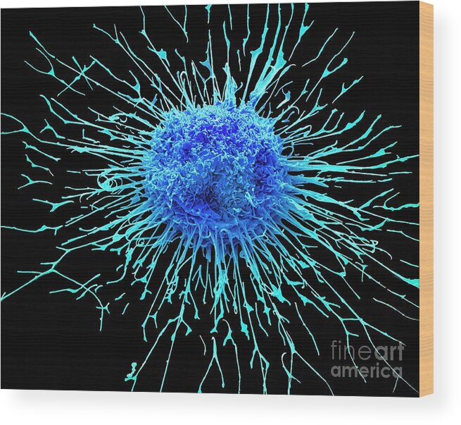 Adenocarcinoma Wood Print featuring the photograph Lung Cancer Cell #10 by Steve Gschmeissner/science Photo Library