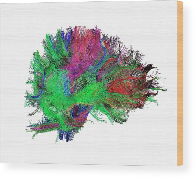 Brain Wood Print featuring the photograph Brain Fibres Side View Right by Do Tromp/science Photo Library