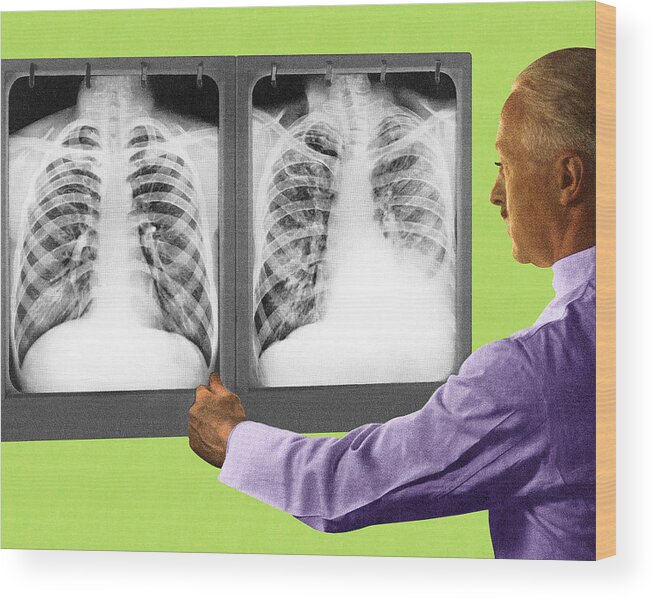 Adult Wood Print featuring the drawing Man Looking at Two Chest X-Rays by CSA Images