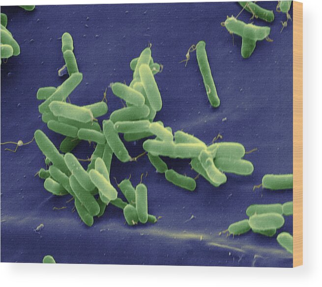 Aerobic Wood Print featuring the photograph Pseudomonas Aeruginosa by Oliver Meckes EYE OF SCIENCE