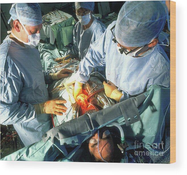 Surgeons perform triple bypass surgery on heart - Stock Image - M560/0214 -  Science Photo Library