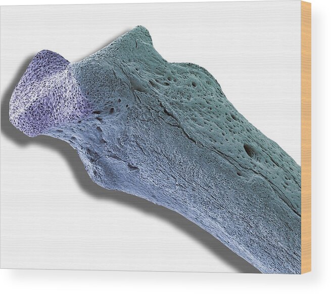 White Background Wood Print featuring the photograph Scanning electron micrograph (SEM) of human bone, osteoporosis by Steve Gschmeissner/spl