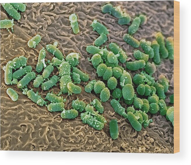 Bacteria Wood Print featuring the photograph Bacteria In The Nose #1 by Steve Gschmeissner/science Photo Library