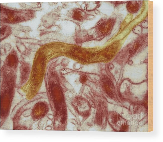 Science Wood Print featuring the photograph Borrelia Burgdorferi Lyme Disease, Tem #1 by David M. Phillips