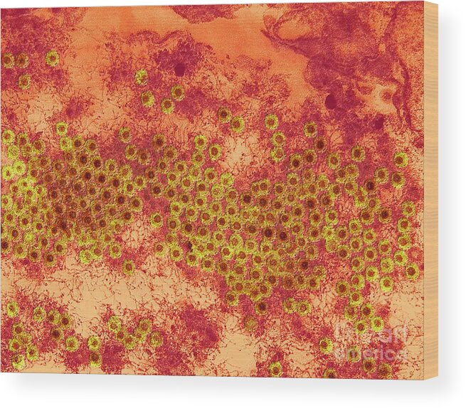 Biological Wood Print featuring the photograph Reovirus Particles, Tem #1 by Ami Images