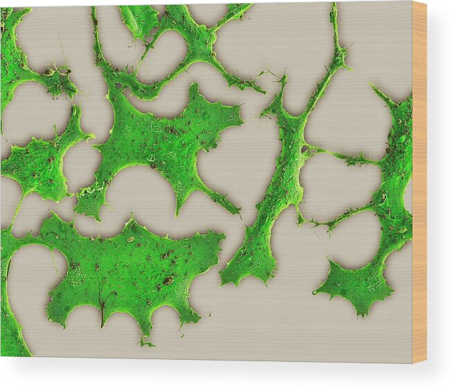Mcf-7 Wood Print featuring the photograph Breast Cancer Cells #2 by Science Photo Library