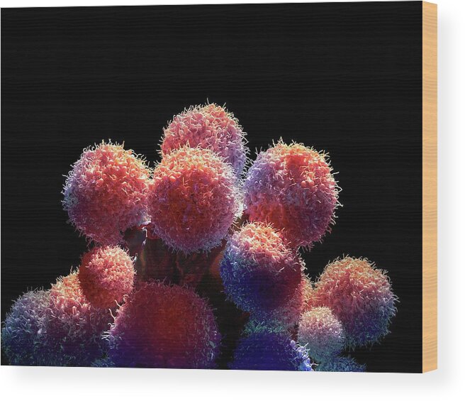 Nobody Wood Print featuring the photograph Cancer Cells #4 by Maurizio De Angelis