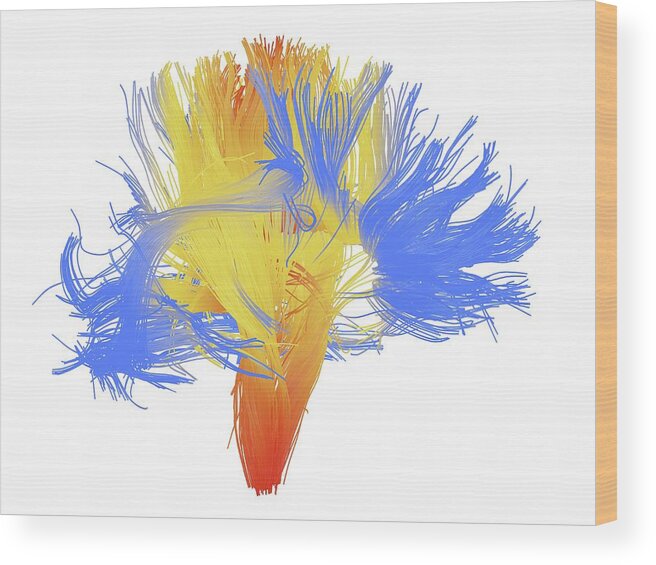Brain Scan Wood Print featuring the photograph White Matter Fibres Of The Human Brain #8 by Alfred Pasieka