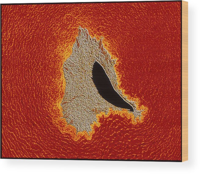 Magnified Image Wood Print featuring the photograph Atherosclerosis by Pasieka
