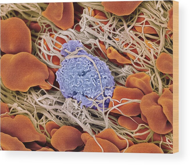 Lymphocyte Wood Print featuring the photograph Blood Clot by Steve Gschmeissner/science Photo Library