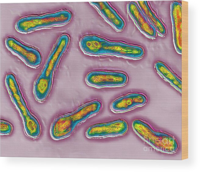 Clostridium Botulinum Wood Print featuring the photograph Clostridium Botulinum Bacteria by James Cavallini