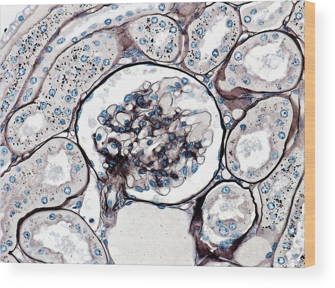 Glomerulus Wood Print featuring the photograph Glomerulus by Microscape
