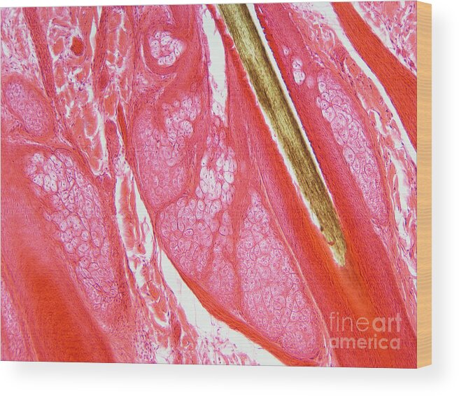 Hair Wood Print featuring the photograph Hair Follicle Lm by Garry DeLong
