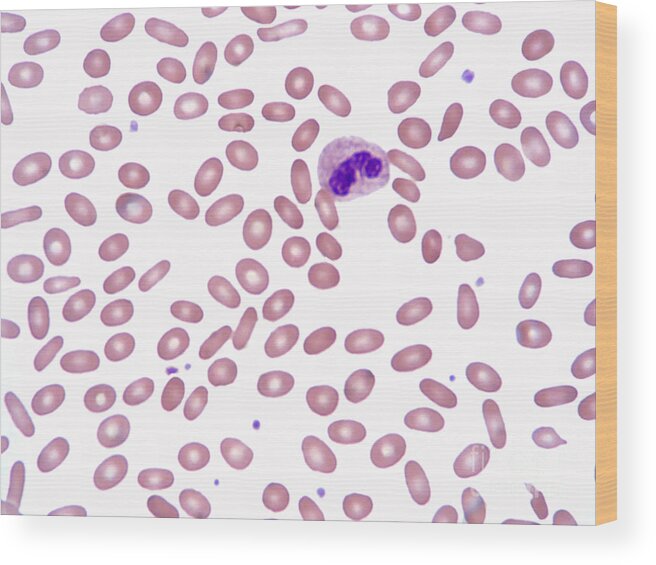 Erythrocyte Wood Print featuring the photograph Ovalocytosis Lm by Garry DeLong