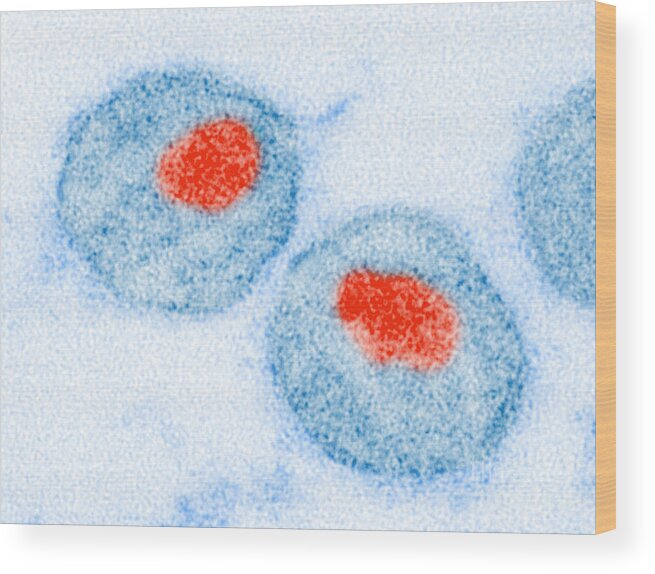 Aids Wood Print featuring the photograph Hiv #2 by Science Source