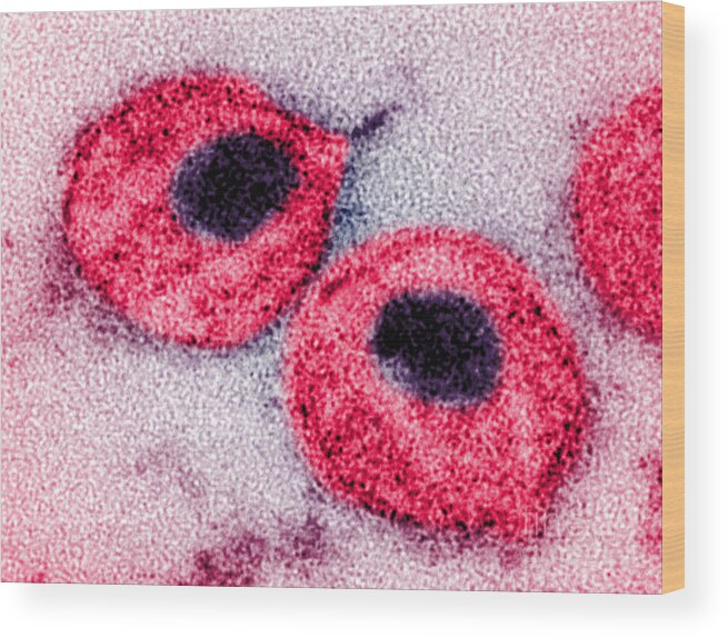 Aids Wood Print featuring the photograph Hiv #3 by Science Source