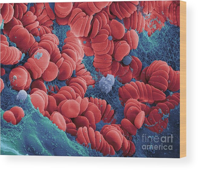 Science Wood Print featuring the photograph Human Red Blood Cells, Sem #16 by Ted Kinsman