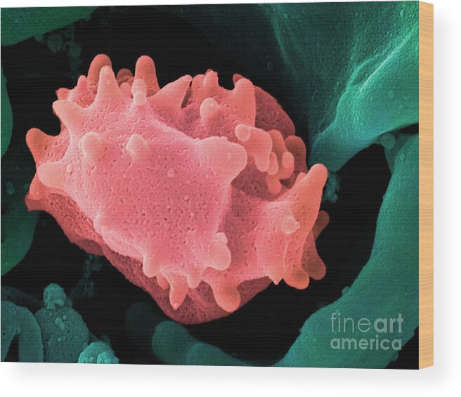 Lymphocyte Wood Print featuring the photograph Human Lymphocyte Cell, Sem #4 by Ted Kinsman