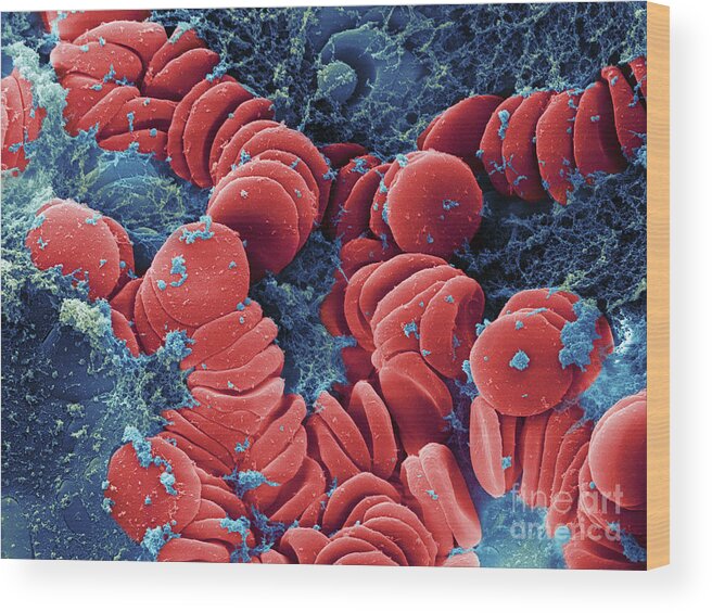 Science Wood Print featuring the photograph Human Red Blood Cells, Sem #5 by Ted Kinsman