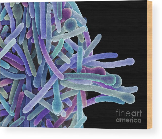 29133 Wood Print featuring the photograph Clostridium Phytofermentans Bacteria #3 by Dennis Kunkel Microscopy/science Photo Library
