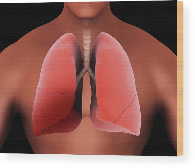 Artwork Wood Print featuring the photograph Inflammation In The Human Lungs Caused by Stocktrek Images