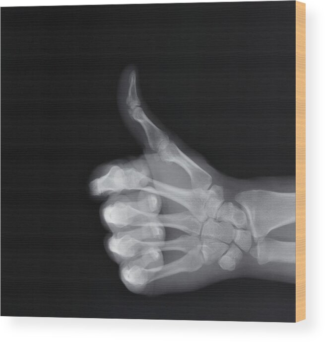People Wood Print featuring the photograph X-ray of hand making thumbs up gesture by ER Productions Limited