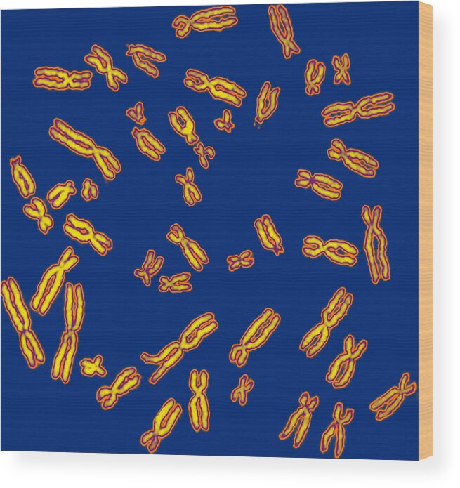 Chromosome Wood Print featuring the photograph Human Chromosomes #5 by Biophoto Associates