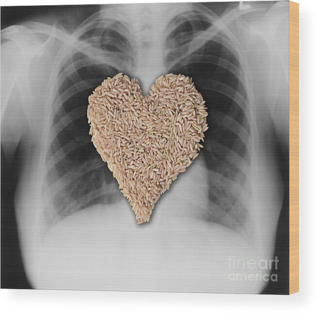 X-ray Wood Print featuring the photograph Brown Rice, Heart Healthy #1 by Gwen Shockey